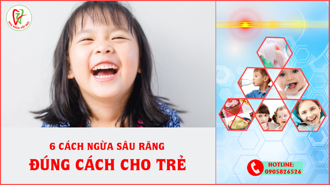 6 CÁCH NGỪA SÂU RĂNG ĐÚNG CÁCH CHO TRẺ