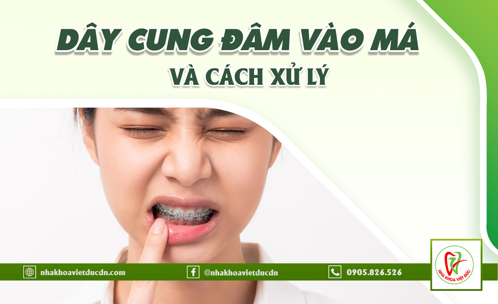 DÂY CUNG ĐÂM VÀO MÁ VÀ CÁCH XỬ LÝ