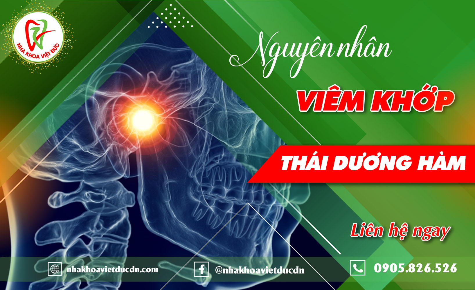 NGUYÊN NHÂN VIÊM KHỚP THÁI DƯƠNG HÀM