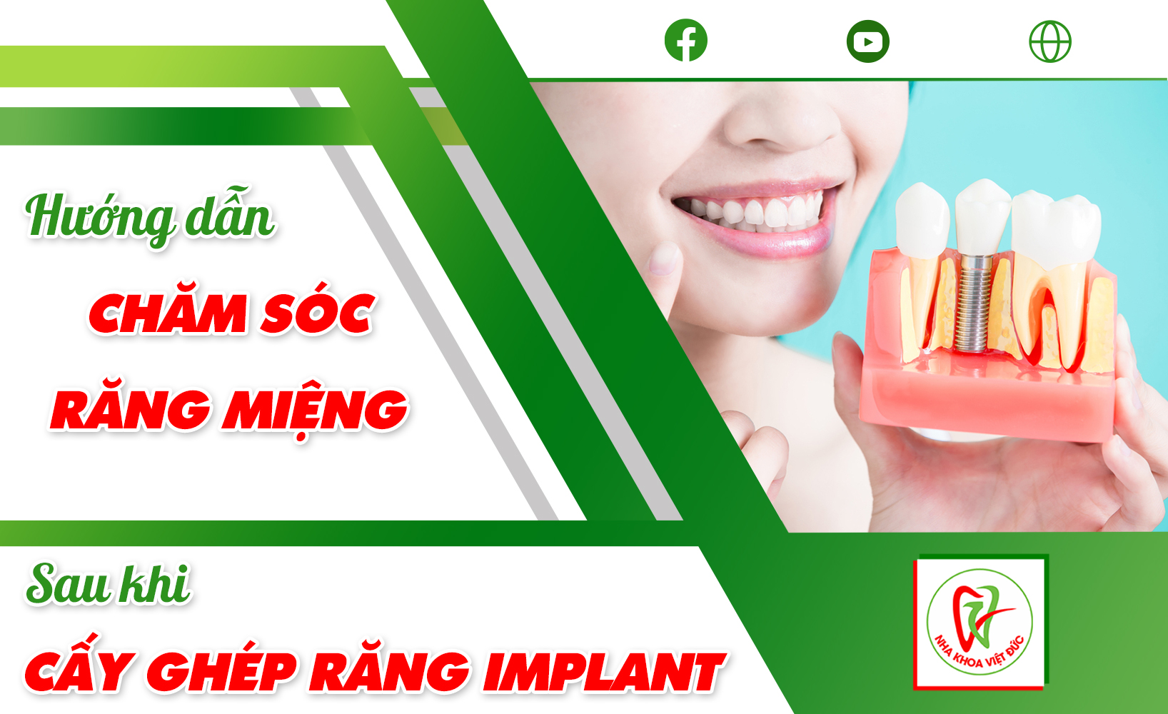 HƯỚNG DẪN CHĂM SÓC RĂNG MIỆNG SAU KHI CẤY GHÉP RĂNG IMPLANT