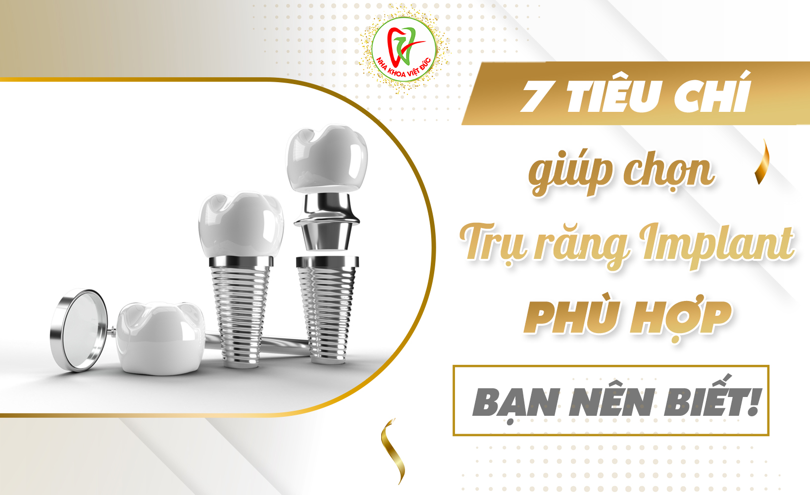 7 TIÊU CHÍ GIÚP CHỌN TRỤ RĂNG IMPLANT PHÙ HỢP BẠN NÊN BIẾT