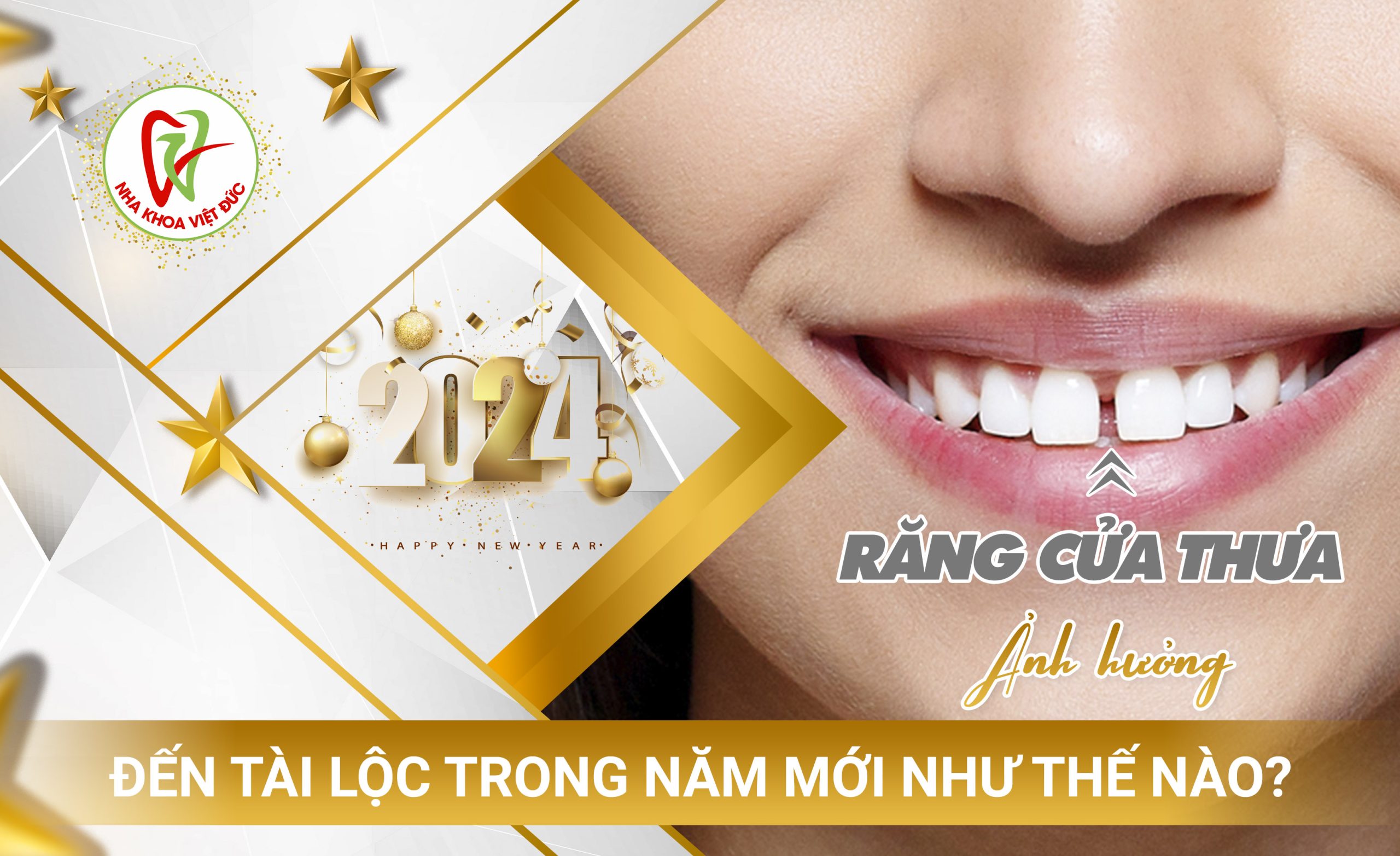 RĂNG CỬA THƯA ẢNH HƯỞNG ĐẾN TÀI LỘC TRONG NĂM MỚI NHƯ THẾ NÀO?