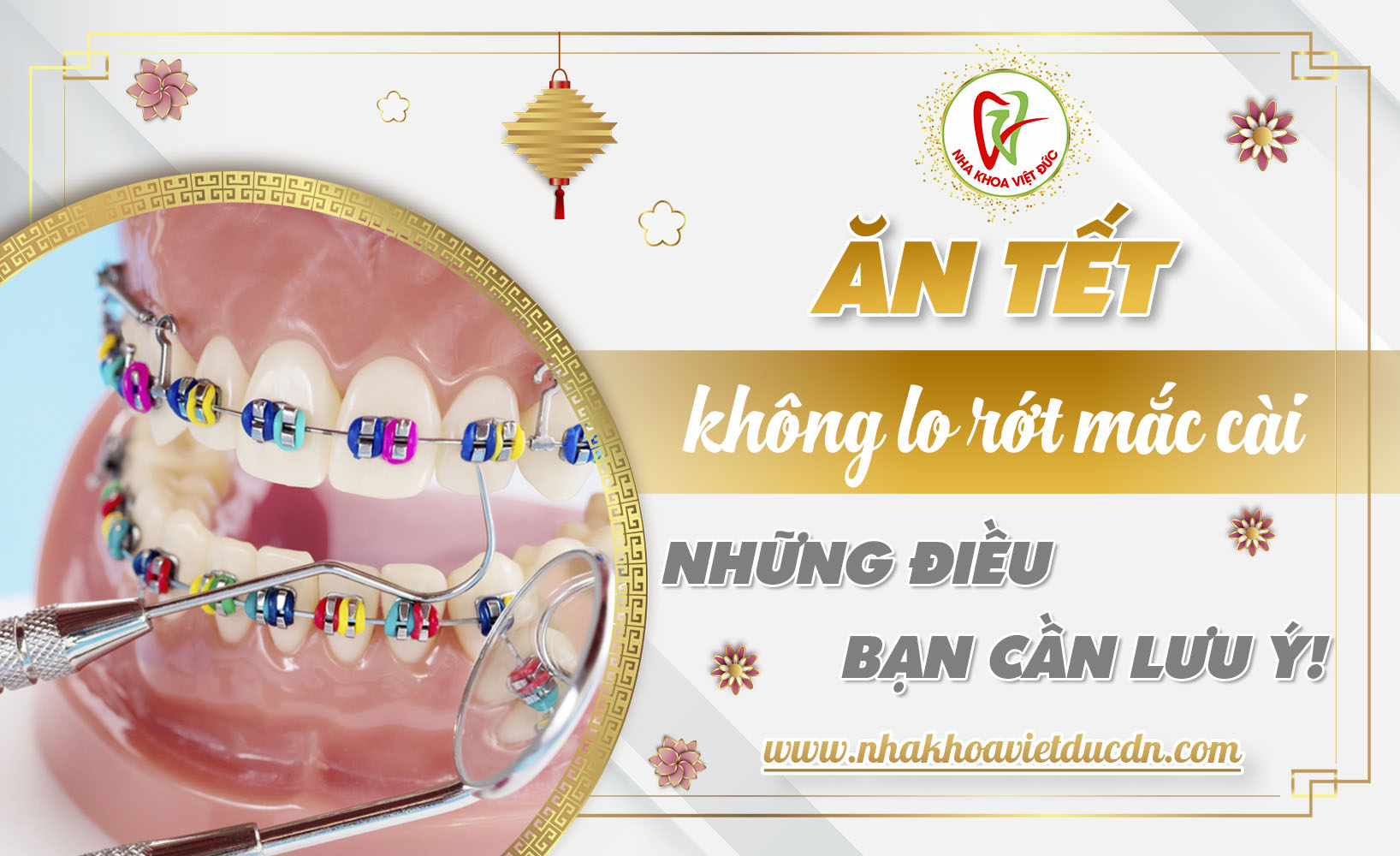 ĂN TẾT KHÔNG LO RỚT MẮC CÀI. NHỮNG ĐIỀU BẠN CẦN LƯU Ý!