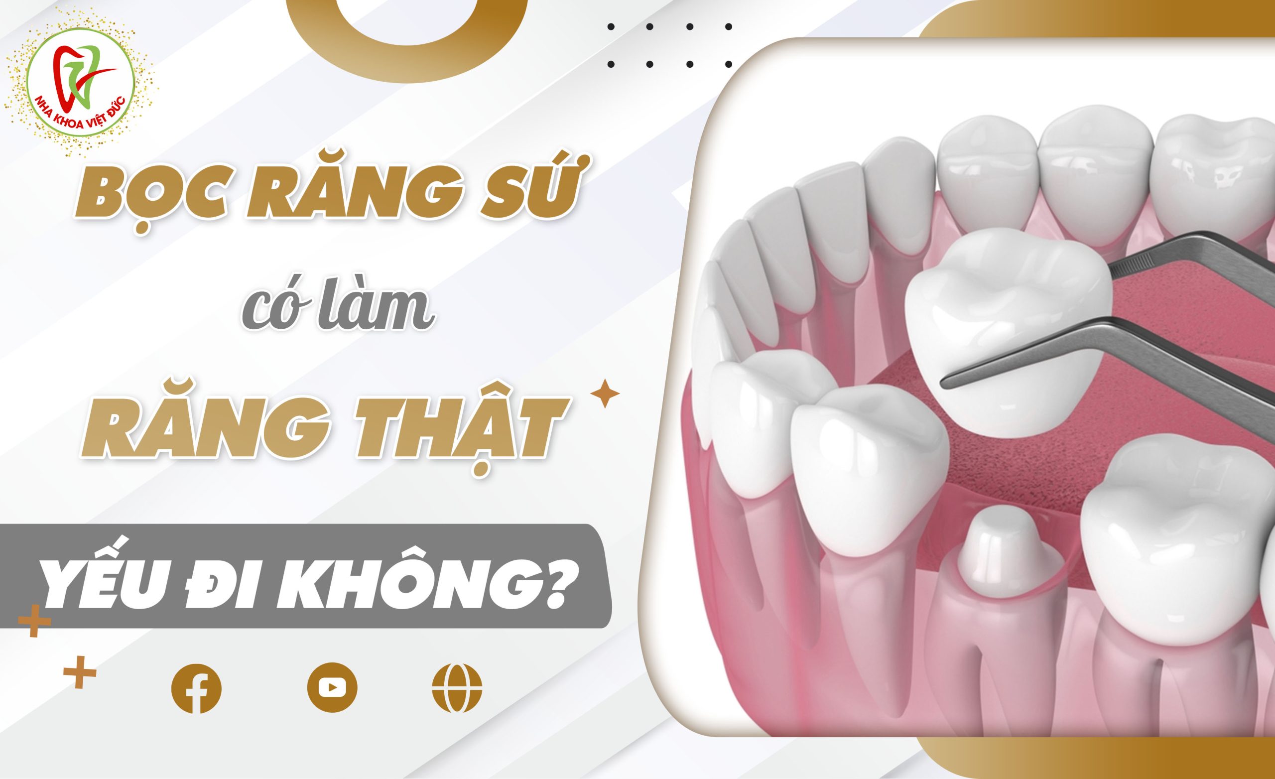 BỌC RĂNG SỨ CÓ LÀM CHO RĂNG THẬT YẾU ĐI KHÔNG?