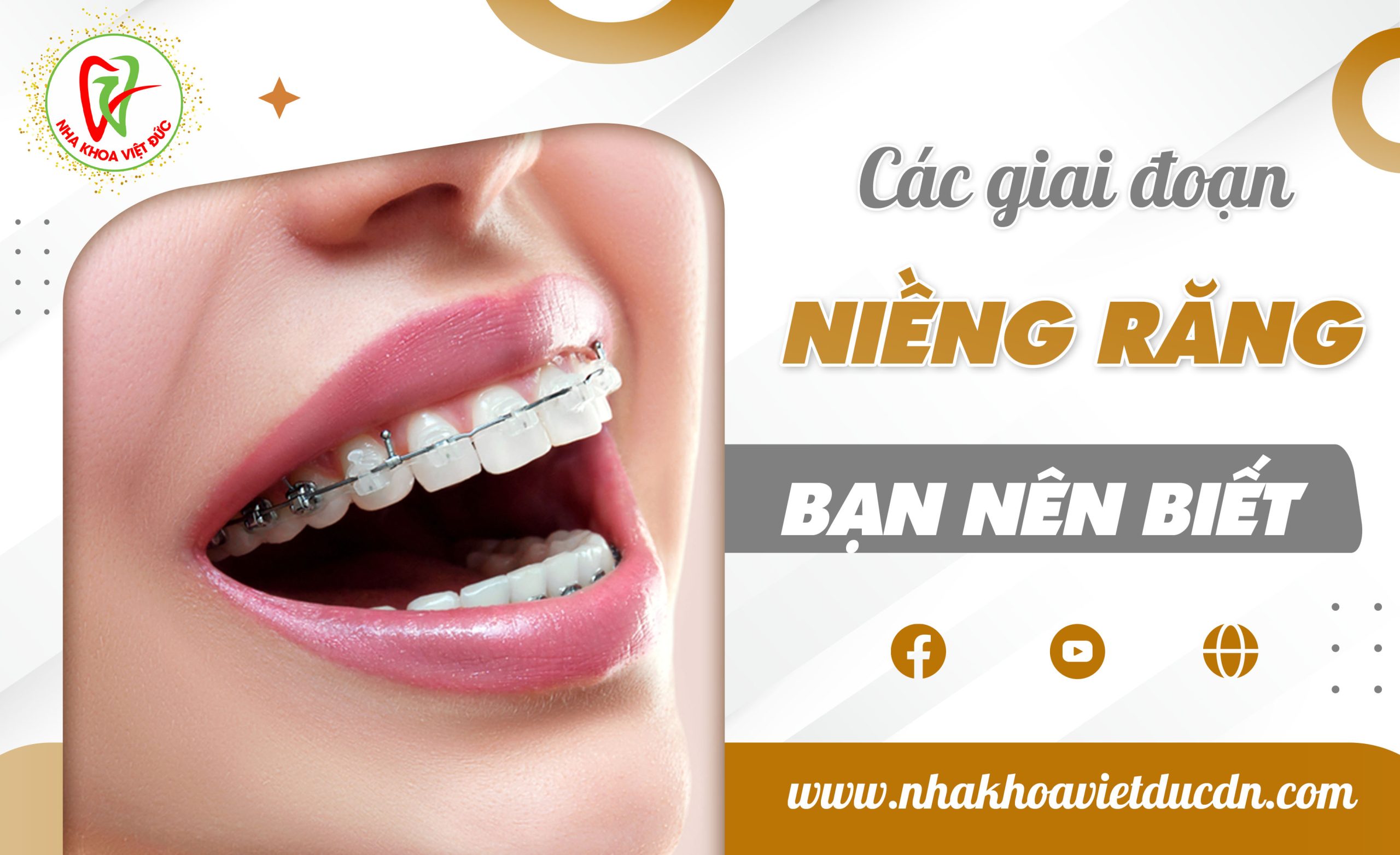 CÁC GIAI ĐOẠN NIỀNG RĂNG BẠN NÊN BIẾT