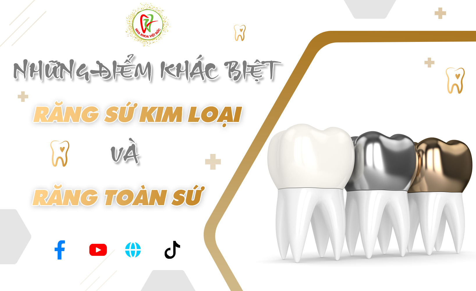 NHỮNG ĐIỂM KHÁC BIỆT GIỮA RĂNG SỨ KIM LOẠI VÀ RĂNG TOÀN SỨ