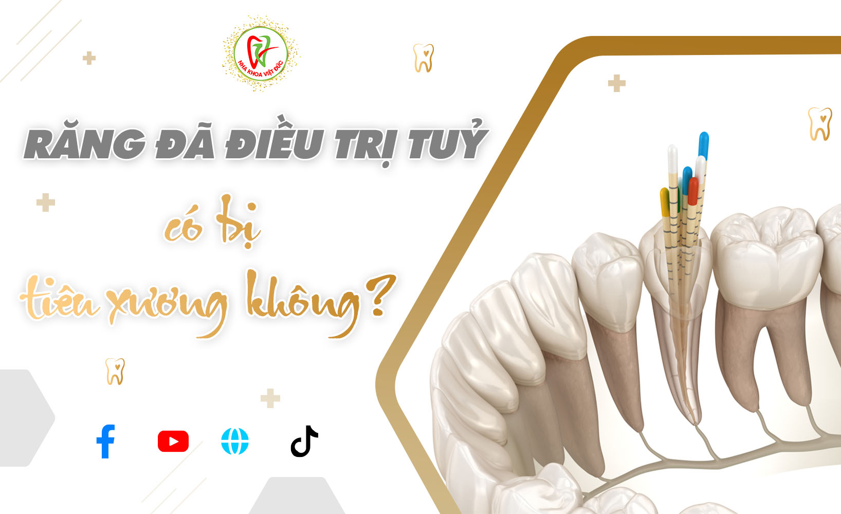 RĂNG ĐÃ ĐIỀU TRỊ TUỶ CÓ BỊ TIÊU XƯƠNG KHÔNG?