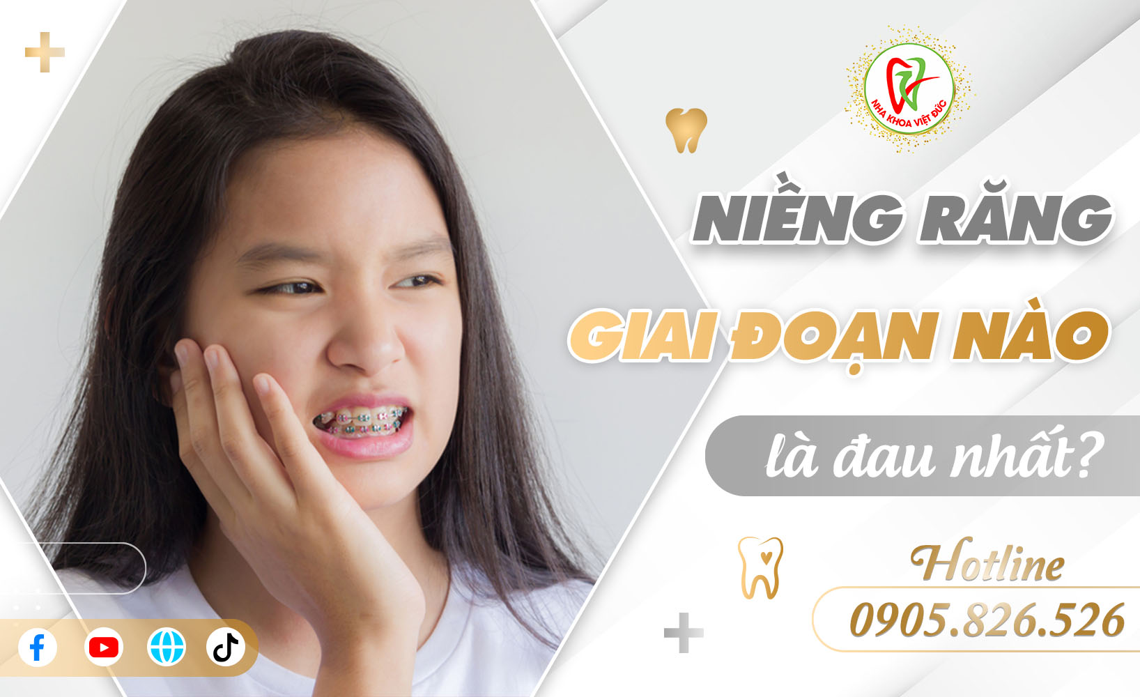 NIỀNG RĂNG GIAI ĐOẠN NÀO LÀ ĐAU NHẤT?